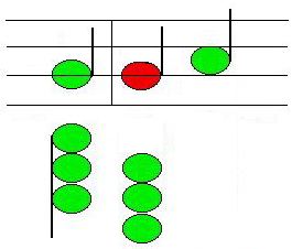 Graphic of Retardation