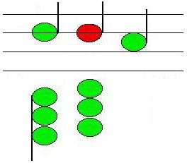 Graphic of Suspension